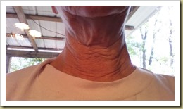 Neck after using Face Life with Activator - Thoughts in Progress.