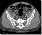 pemeriksaan radiology abdomen