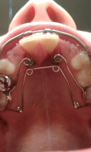Orthodontist «Newell Orthodontics: Bill Newell, DMD», reviews and photos