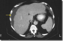 pemeriksaan radiology ct abdomen