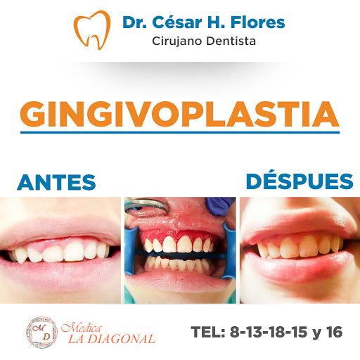 Dr. César Hernán Flores Flores, Av Diagonal Cuauhtemoc 10 y 11 No. 423, Zona Centro, 87300 Matamoros, Tamps., México, Dentista | TAMPS