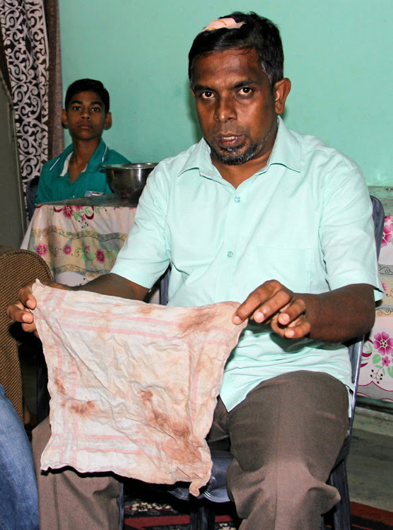 Local politician Abdul Saleel Mohamed Fazil, who alleges he was beaten by Sri Lankan police during anti-Muslim riots shows his bloody shirt in Kandy, Sri Lanka March 16, 2018.