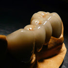 5 Reasons Not To Worry About A Root Canal Procedure post image