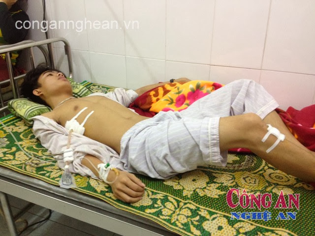 Nạn nhân Lê Hải Đăng khi còn điều trị tại Bệnh viện Đa khoa TP Vinh