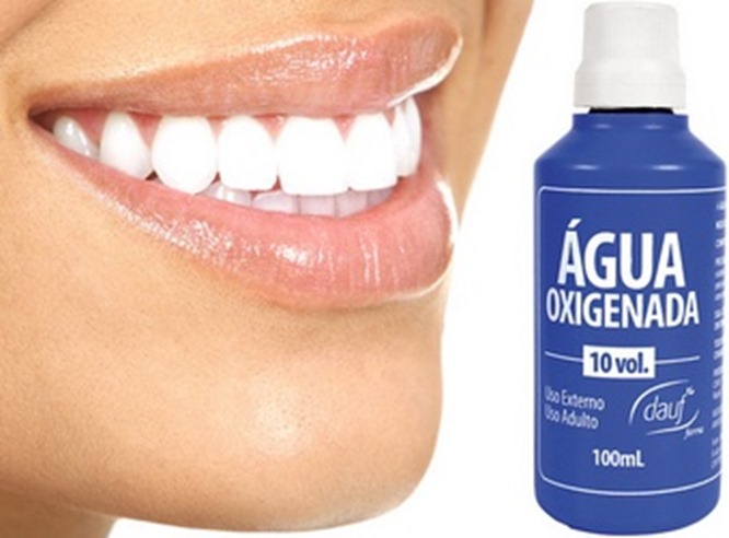 agua-oxigenada-clareia-os-dentes