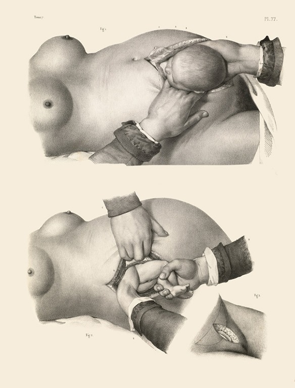 [Surgery-from-the-past-5%255B4%255D.jpg]