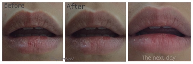 EOS Lipbalm Application, Chapped Lips