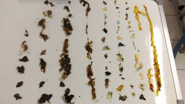 Plastic removed from the stomach of a sea turtle during a necropsy, 27 October 2015. Photo: Charles Moore
