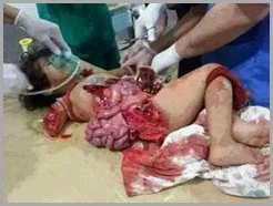 O governo do PT como Dilma socialistas jamais apoiarão as atrocidades ás crianças palestinas.
