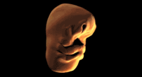[embrio%255B3%255D.gif]