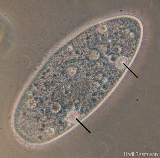 Vakuola kontraktil (ditunjuk garis hitam) pada Paramecium aurelia