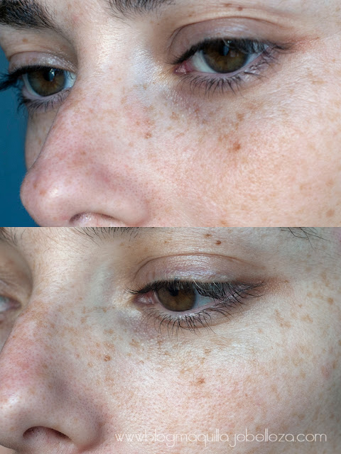 Antes y después.Resultados tras una semana con Glow Revival. Antes y después.Resultados tras una semana con Glow Revival.