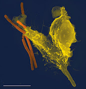 A scanning electron microscope image of a single neutrophil (yellow), engulfing anthrax bacteria (orange). This is part of the immune system. File photo.