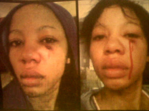 Kelly Khumalo's abused face