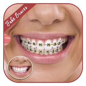 Download Fake Braces For PC Windows and Mac