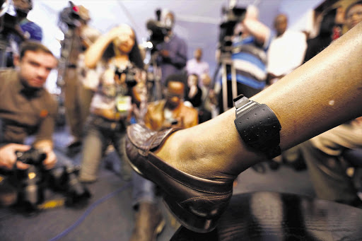IN THE SPOTLIGHT: Kgoputso Phala, one of the 500 parolees to be fitted with an electronic monitoring system by the Department of Correctional Services to keep an eye on early-release prisoners, shows the device to the media