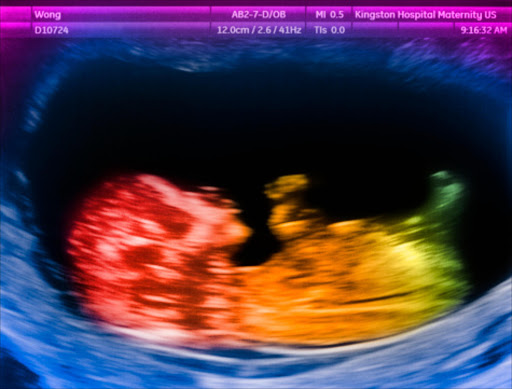 12 week old baby scan