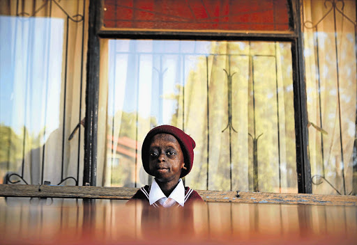 MISS CONFIDENCE: Ontlametse Phalatse, is the world's only known black female with progeria, a disease that accelerates ageing in children.