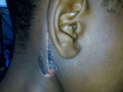 A pupil shows injuries on the neck after an assault. Photo/Mathews Ndanyi