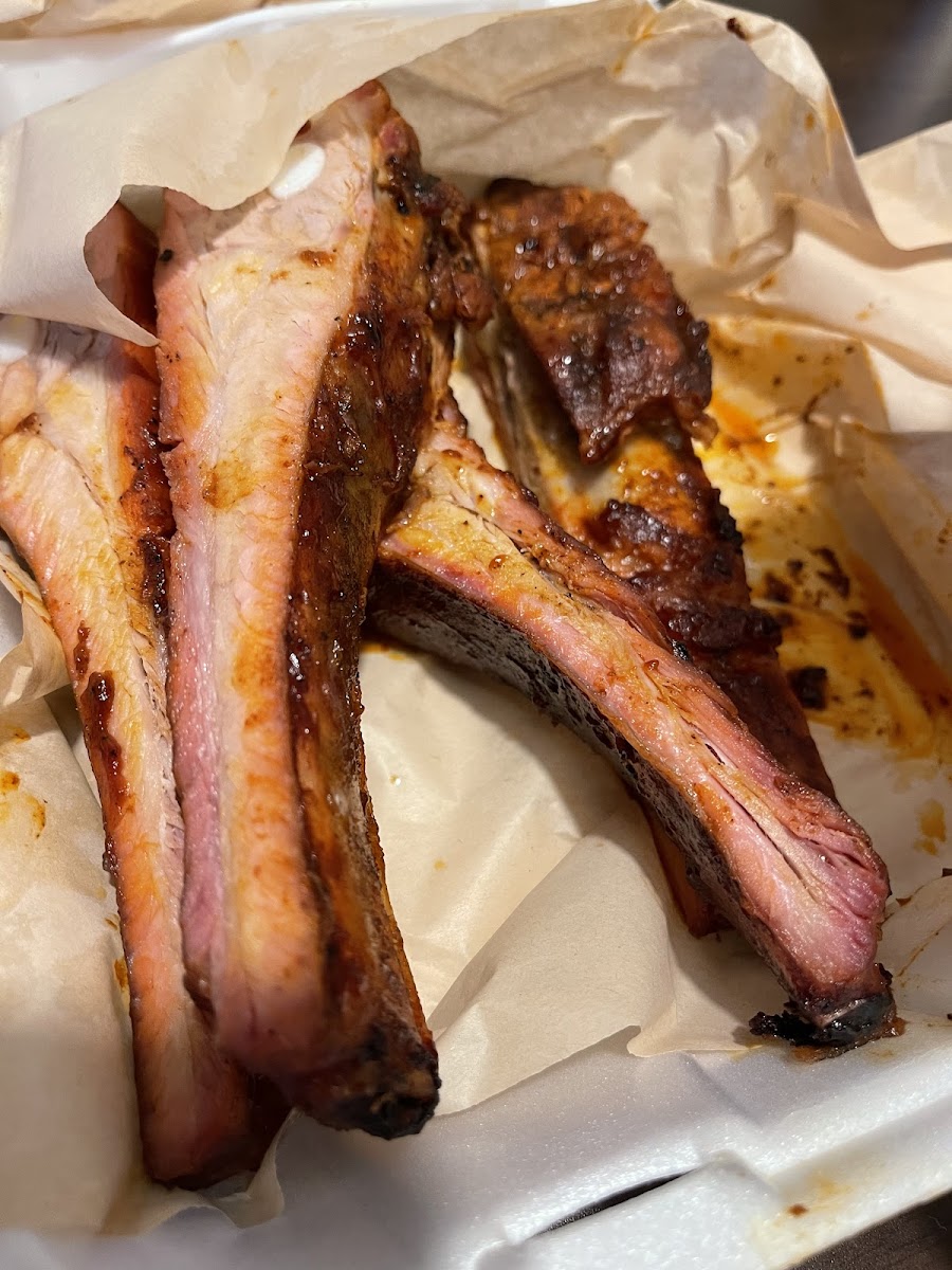 The ribs