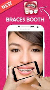How to install Braces Stickers Photo Booth 2.0 mod apk for android