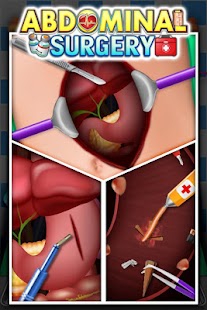 How to install Abdominal Surgery Simulator - Crazy Doctor Game lastet apk for pc