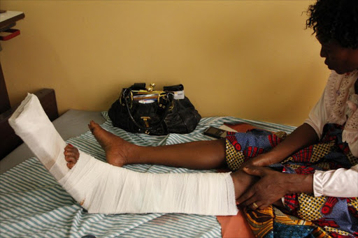 Gerturde Sumbamala holds her left leg on a bed in a hospital in Accra, after it was broken in a crush in an evangelist church of Accra, on May 19, 2013. The offer of free anointing water at a popular church caused a stampede that killed four and wounded 30 on May 19 in Ghana, west Africa's second largest economy.