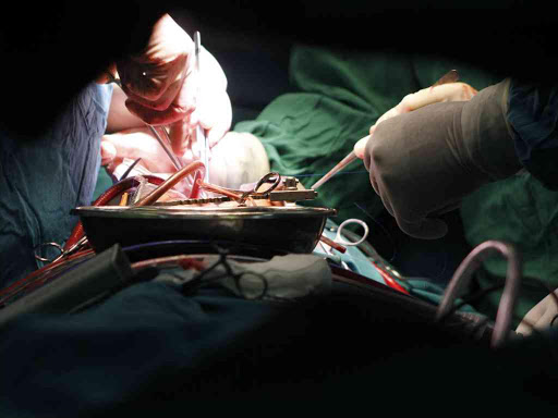A file photo of doctors carrying out open heart surgery. MONICA MWANGI