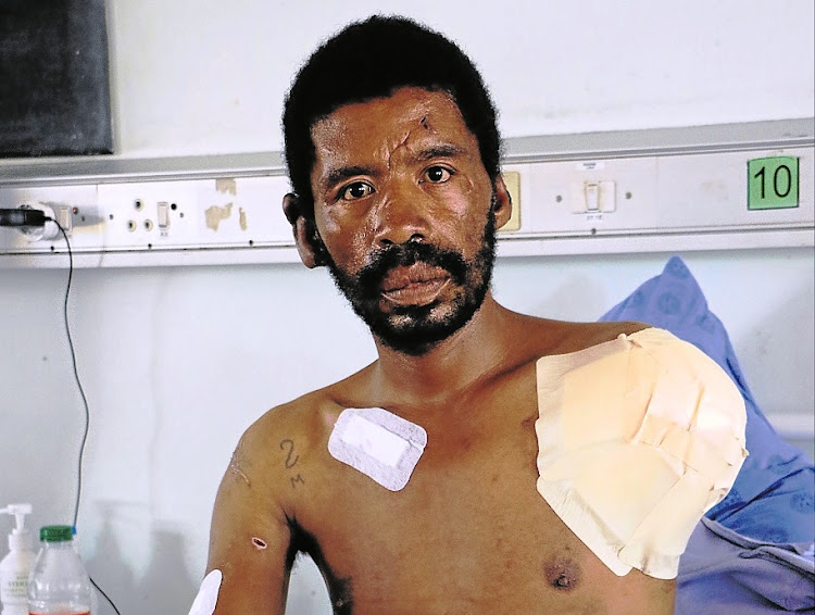 Gerald Cloete in hospital in Port Elizabeth after Christiaan van Meyeren's three pitbull-type dogs ripped off his arm in February 2017.
