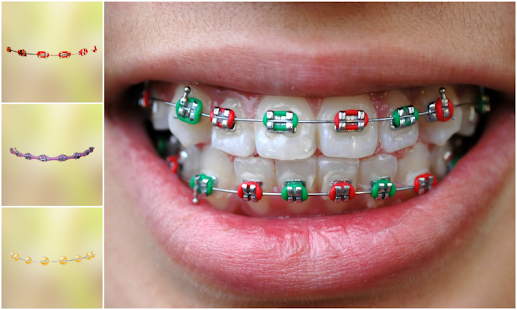 How to mod Real Teeth Braces Photo Maker 1.0 apk for laptop