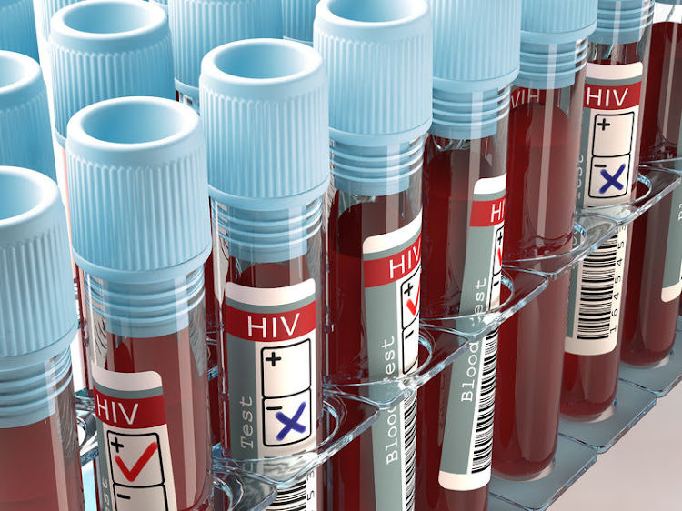 About 7.8-million people are living with HIV in SA, making the country the epicentre of the virus. Stock photo.