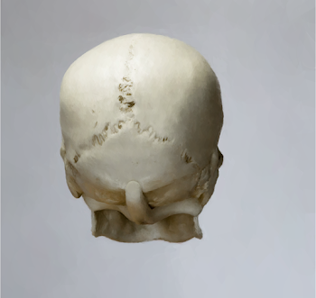 Skull 7