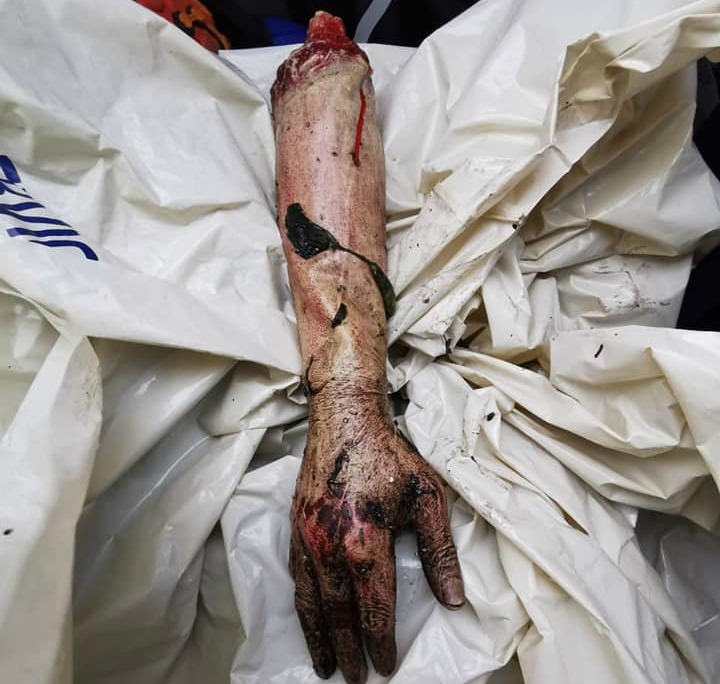The life-like prosthetic arm that was found in the harbour.