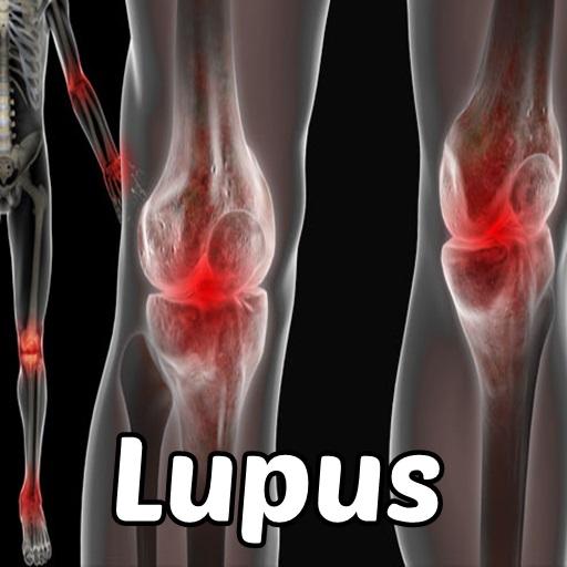 Android application Lupus Symptoms Disease screenshort