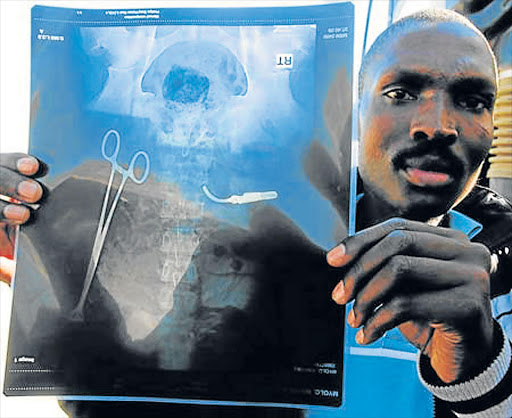 LONG WAIT: Wandisile Myolwa still struggles to lift heavy things after surgical instruments were left in his abdomen at the Nelson Mandela Academic Hospital eight years ago File picture: LULAMILE FENI
