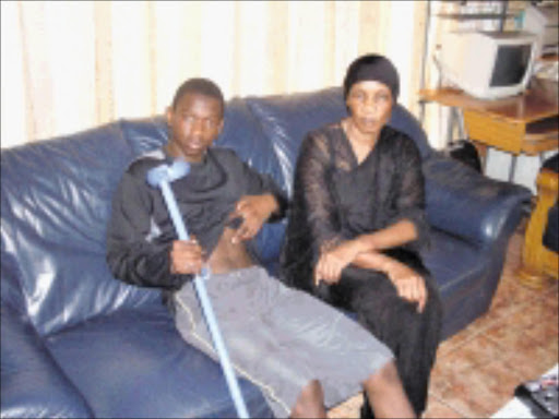 BRUISED: Tshepiso Mohlala and her mother Bonny claim that police inflicted pain on them. 31/01/09. Pic. Riot Hlatshwayo. © Sowetan.
