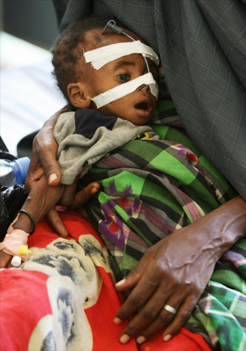 A mother holding her child who is suffering from malnutrition and diarrhoea at the Gift of Givers make-shift hospital on September 7, 2011 in Somalia. South African based disaster relief organisation Gift of the Givers is on a relief mission to provide medical assistance and food aid to the desperate famine stricken people of Somalia.