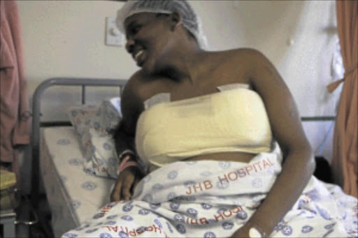 Mavis, 29, of Vosloorus, after the breast reduction operation that was performed on her at the Charlotte Maxege Hospital in Johannesburg recently. PHOTO: BUSISIWE MBATHA