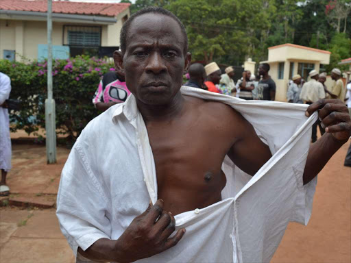 NEEDS TREATMENT: Lengo Mdzomba displays the armpit with the tumour at Kwale law courts on Monday.
