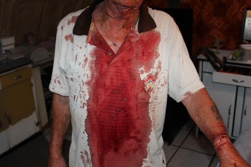 The bloody shirt of Bruce Harvey, a victim of a farm attack in northern KZN, shows the extent of the violence that faced him and wife Denise on Wednesday afternoon.