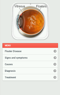 How to get Floater Disease patch 0.0.1 apk for laptop
