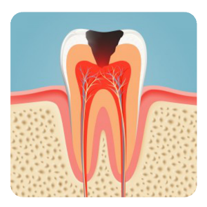 Download Dental Caries For PC Windows and Mac