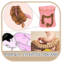 ダウンロード All Stomach Diseases and Treatment をインストールする 最新 APK ダウンローダ