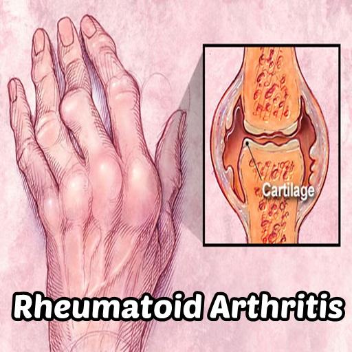 Android application Rheumatoid Arthritis screenshort