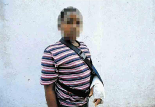 PAINFUL STORY: A 12-year-old pupil has a broken arm, allegedly as a result of an assault by a teacher Picture: SINO MAJANGAZA