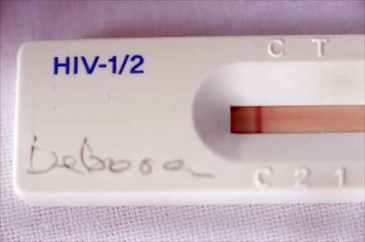 HIV testing kit. File photo.