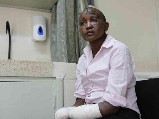 Jackline Mwende at PCEA Kkikuyu Hospital where she is being treated following a panga attack believed to have been by her husband Stephen Ngila. /MONICAH MWANGI