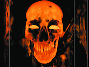 A skull. file picture