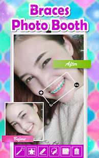 How to get Braces Photo Booth lastet apk for laptop
