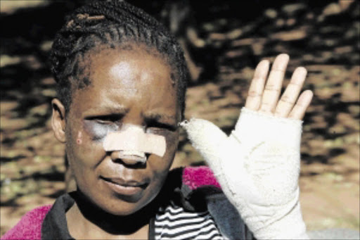 SPEAKING OUT: Rape victim Bongiwe Mnguni says she has decided to go public about her ordeal in order to highlight security issues at hospitalsphoto: ANTONIO MUCHAVE